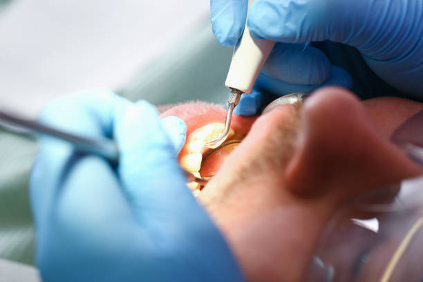 Best Emergency Tooth Extraction in Goldsby, OK