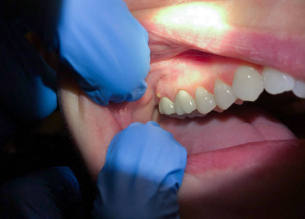 Best Urgent Care for Lost Fillings or Crowns in Goldsby, OK