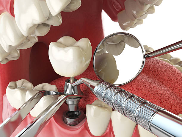 Best Emergency Tooth Extraction in Goldsby, OK